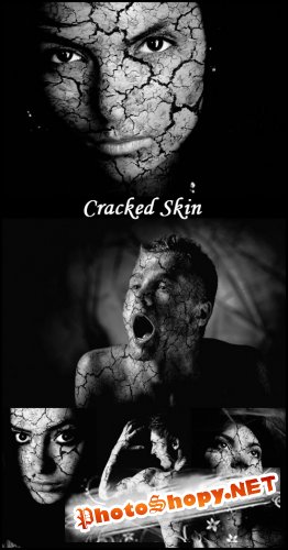 Cracked Skin - Stock Photos